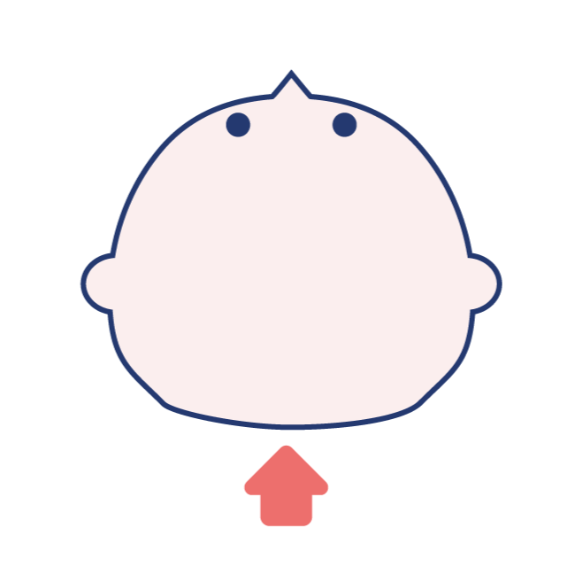 短頭症の図