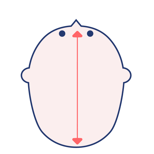 長頭症の図